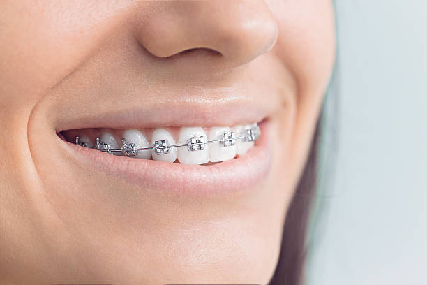 Best Teeth Whitening  in Dickson, TN